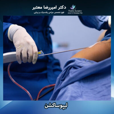 لیپوساکشن - دکتر معتبر